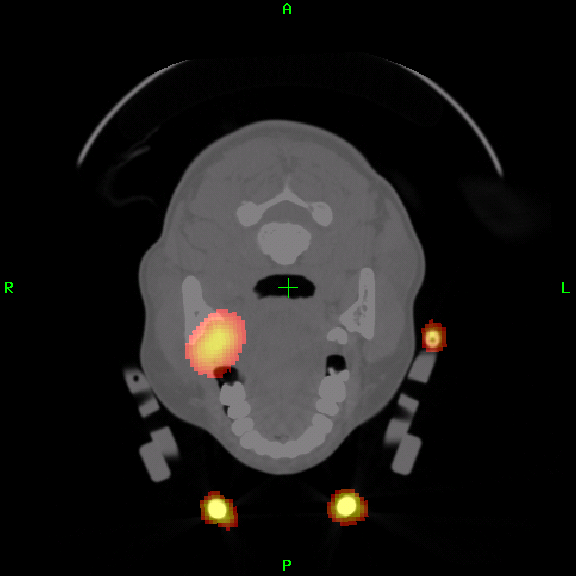 Alignment of PET Imaging to Histology for Verification of Tumour Boundaries
